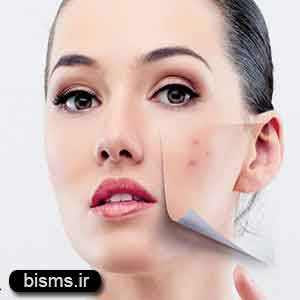 داشتن پوست صاف داشتن پوست صاف